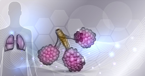 Dentists and Idiopathic Pulmonary Fibrosis